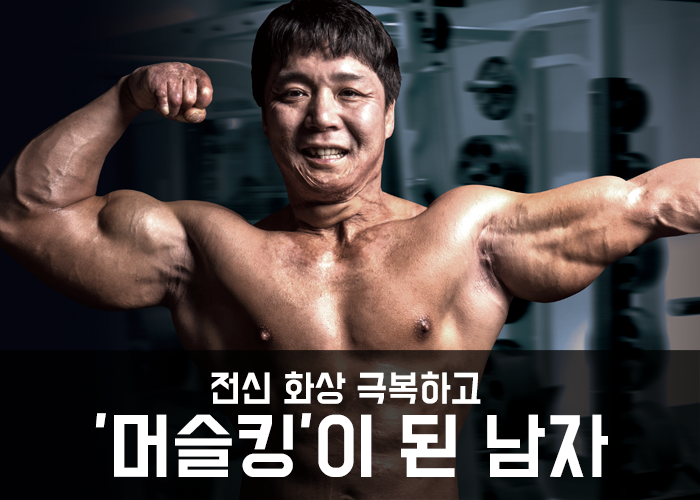 전신 화상 극복하고 머슬킹이 된 남자 조형원의 대포알 팔 운동 3... 전신 화상 극복하고 머슬킹이 된 남자 조형원의 대포알 팔 운동 3